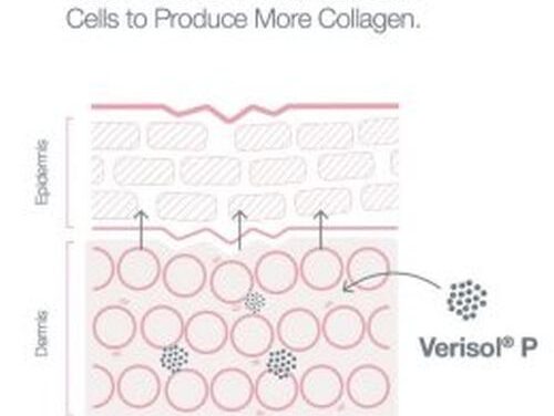 What Is Verisol P Collagen? How Does It Work?